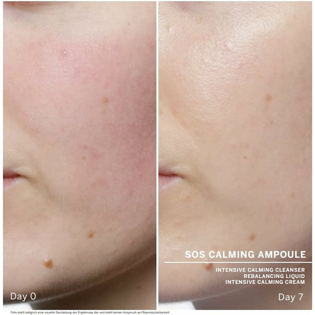 Facial Treatment Babor Sos Calming 7x2 ml.