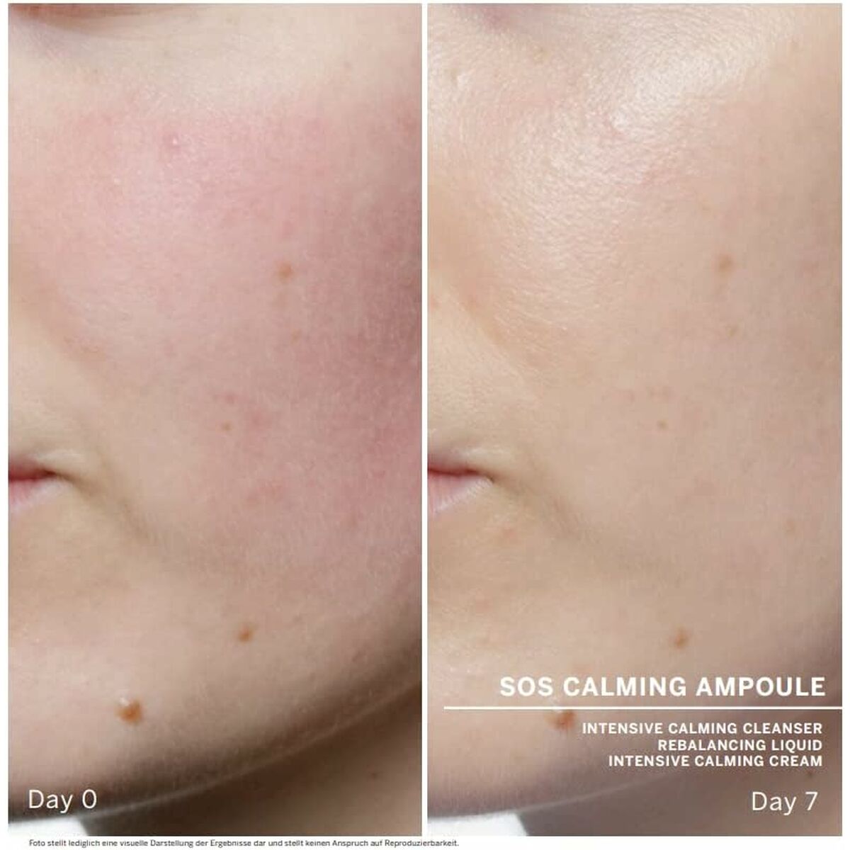 Facial Treatment Babor Sos Calming 7x2 ml.